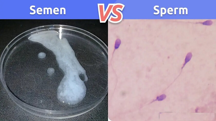 Are Sperm And Semen The Same Thing? Find Out!